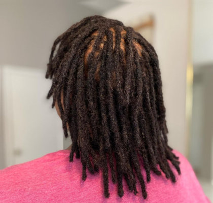 scalp of a human